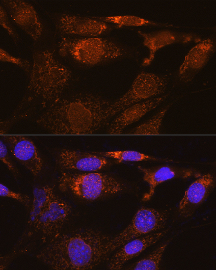 Anti-SYNE3 Antibody (CAB13237)