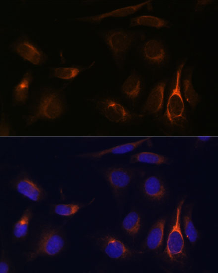 Anti-VMP1 Antibody (CAB15523)