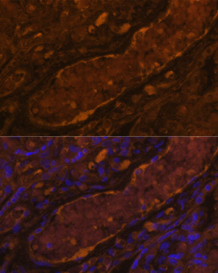 Anti-CFI Antibody (CAB5623)