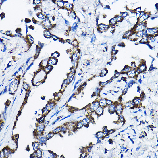 Anti-MSRB2 Polyclonal Antibody (CAB8364)