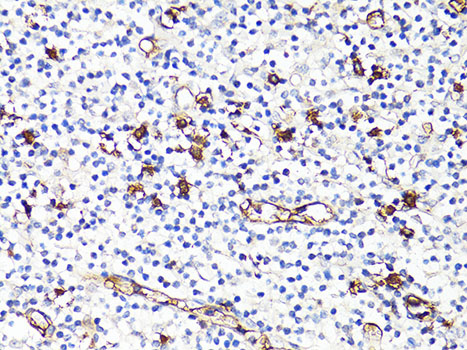 Anti-Protein S100-A9 Polyclonal Antibody (CAB9842)