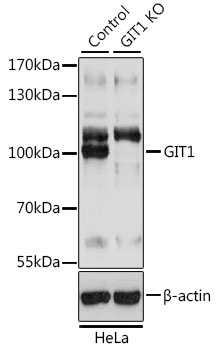 Anti-GIT1 Antibody [KO Validated] (CAB15437)