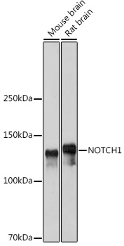 Anti-NOTCH1 Antibody [KO Validated] (CAB16675)