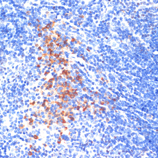 Anti-TLR4 Antibody [KO Validated] (CAB11226)