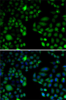 Anti-EPC1 Antibody (CAB5807)