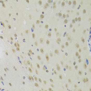 Anti-PRPF3 Antibody (CAB5482)