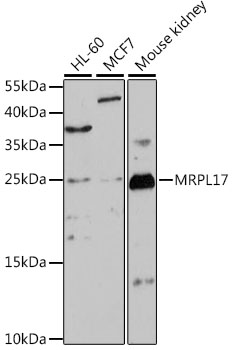 Anti-MRPL17 Antibody (CAB15603)