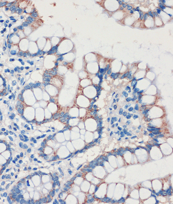 Anti-CHDH Antibody (CAB16545)