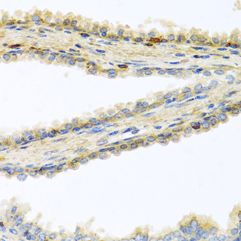 Anti-GPLD1 Antibody (CAB6612)