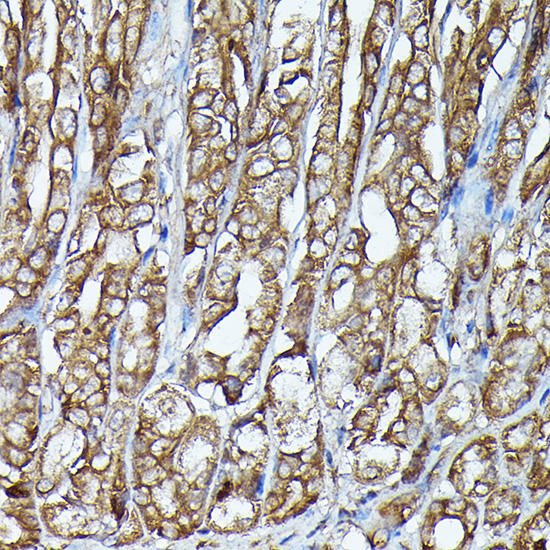 Anti-JAK2 Antibody (CAB11497)