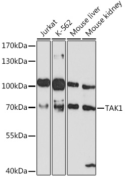 Anti-TAK1 Antibody (CAB12022)