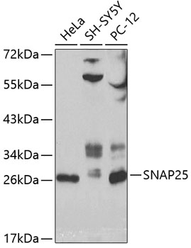 Anti-SNAP25 Antibody (CAB0986)