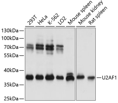 Anti-U2AF1 Antibody (CAB13166)