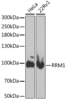 Anti-RRM1 Antibody (CAB13656)