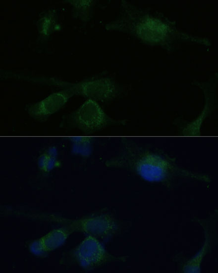 Anti-VHL Antibody (CAB0377)