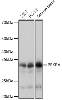 Anti-PRKRA Antibody (CAB8779)