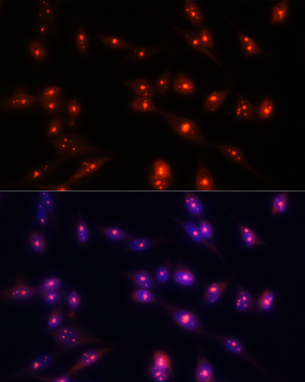 Anti-FBL Antibody (CAB13490)