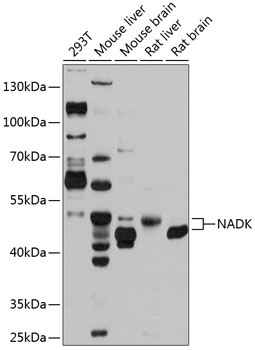 Anti-NAD kinase Polyclonal Antibody (CAB9111)