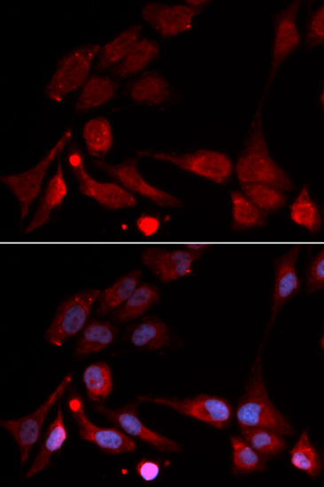 Anti-APBB1 Antibody (CAB1944)