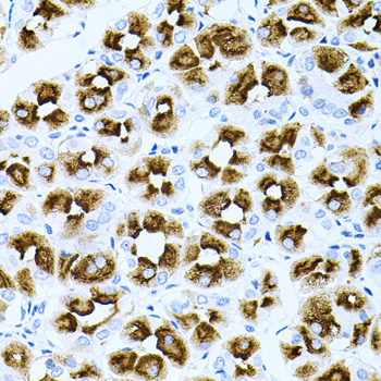 Anti-DLK1 Antibody (CAB6578)