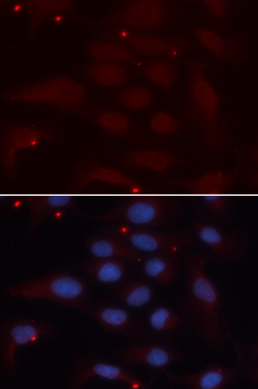 Anti-KPNA1 Antibody (CAB13623)