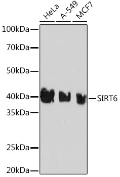 Anti-SIRT6 Antibody (CAB3591)