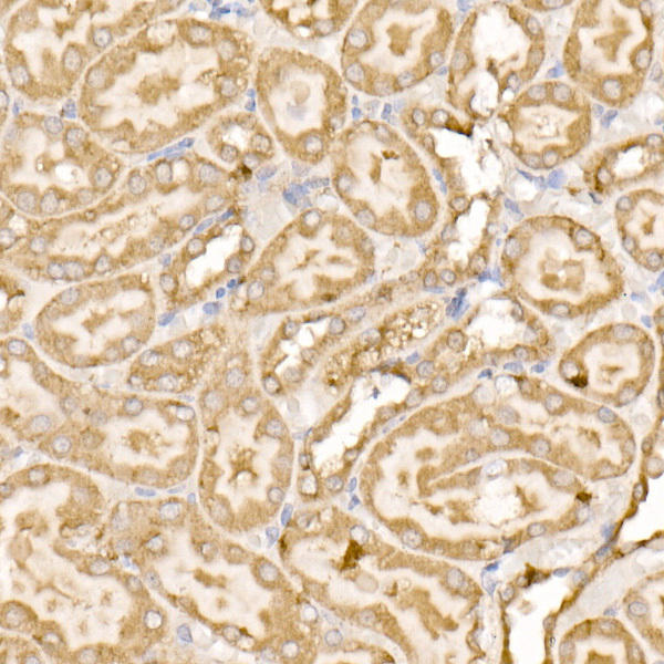 Immunohistochemistry of paraffin-embedded rat kidney using SDHC Rabbit pAb at dilution of 1:100 (40x lens). Perform high pressure antigen retrieval with 10 mM citrate buffer pH 6. 0 before commencing with IHC staining protocol.