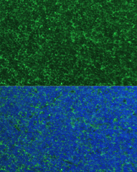 Anti-PMAIP1 Polyclonal Antibody (CAB9801)