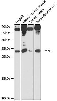 Anti-MYF6 Antibody (CAB15291)