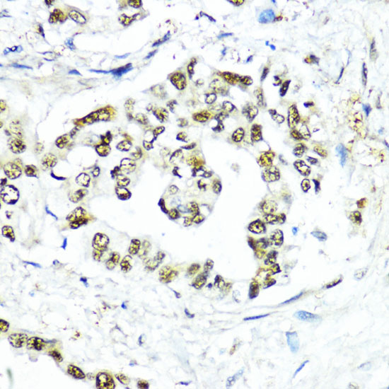 Anti-SUMO1 Antibody (CAB2130)