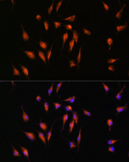 Anti-MMP9 Antibody (CAB0289)