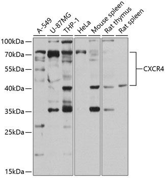 Anti-CXCR4 Antibody (CAB13672)