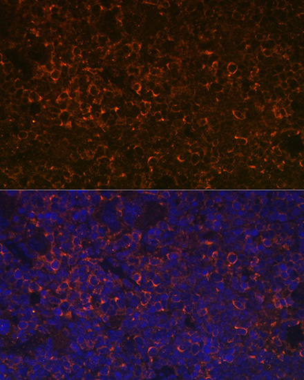 Anti-CD38 Antibody (CAB1680)