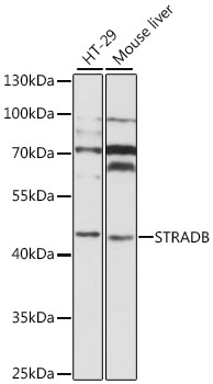 Anti-STRADB Polyclonal Antibody (CAB8651)