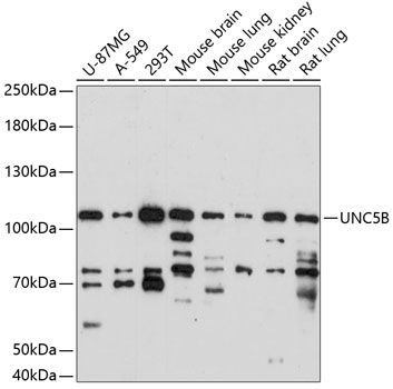 Anti-UNC5B Antibody (CAB14978)