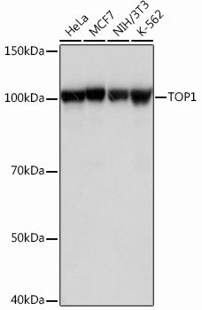 Anti-TOP1 Antibody