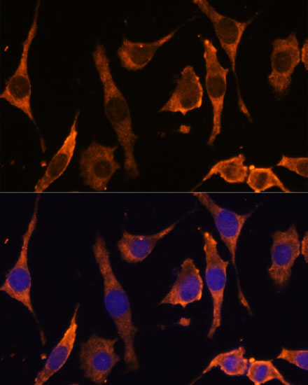 Anti-RPL36AL Antibody (CAB14366)