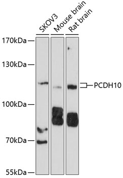 Anti-PCDH10 Antibody (CAB10150)