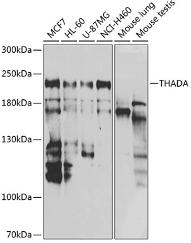 Anti-THADA Antibody (CAB7129)