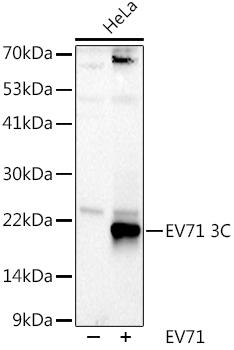 Western blot analysis of extracts of HeLa cells, using EV71 3C antibody at 1:1000 dilution. Secondary antibody: HRP Goat Anti-Rabbit IgG (H+L) at 1:10000 dilution. Lysates/proteins: 25ug per lane. Blocking buffer: 3% nonfat dry milk in TBST. Detection: ECL Basic Kit. Exposure time: 90s.