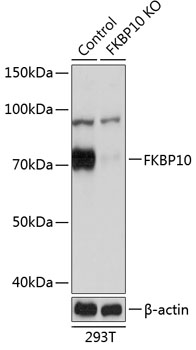 Anti-FKBP10 Antibody [KO Validated] (CAB19870)