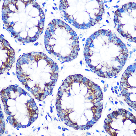 Anti-CYP11A1 Antibody (CAB1713)