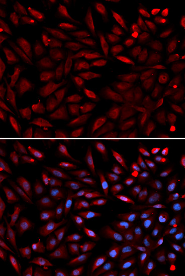 Anti-PSMC2 Antibody (CAB1985)