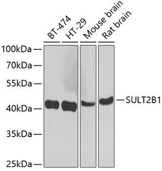 Anti-SULT2B1 Antibody (CAB7736)