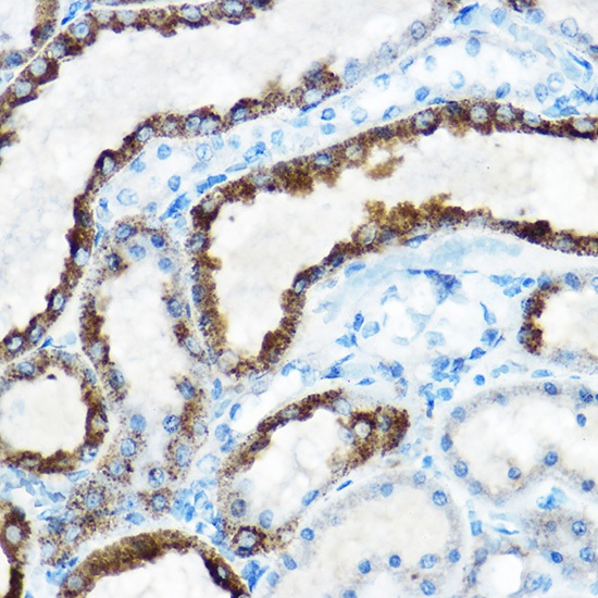 Anti-OAT Antibody (CAB6235)