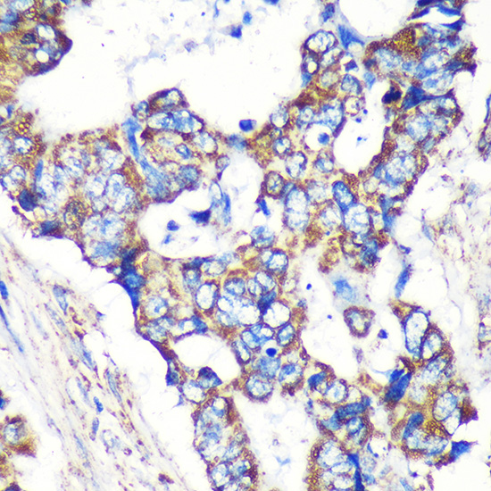 Anti-STARD3NL Antibody (CAB16579)