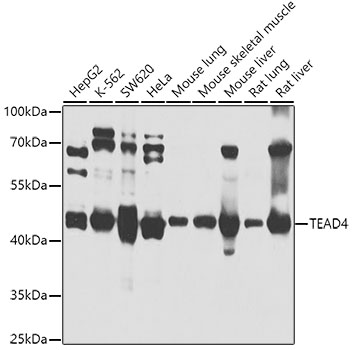 Anti-TEAD4 Antibody (CAB4151)