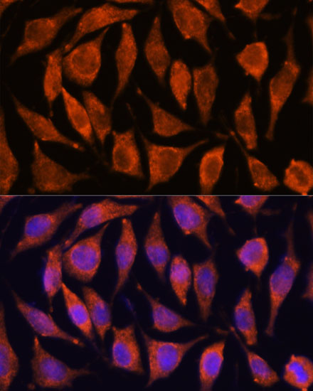 Anti-TNFAIP8L2 Antibody (CAB13698)