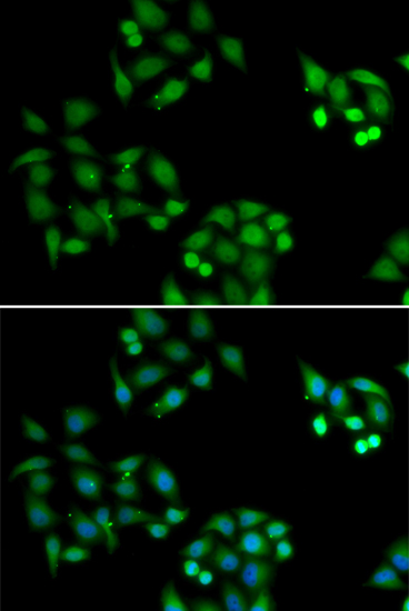 Anti-NSFL1C Antibody (CAB6677)