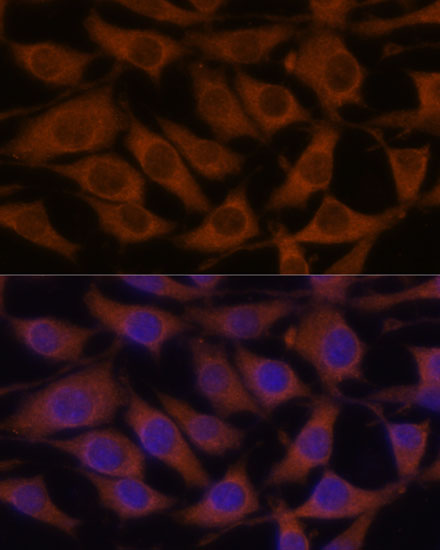 Anti-CREB3 Antibody (CAB6567)